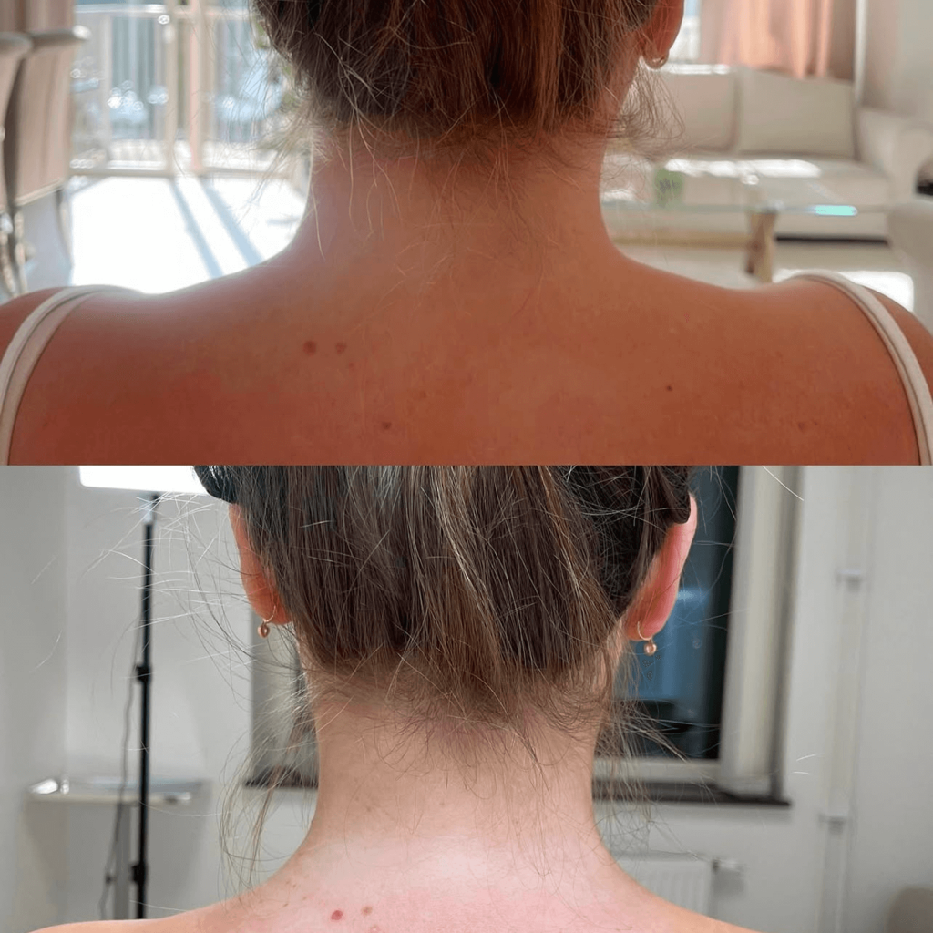 Traptox före & efter